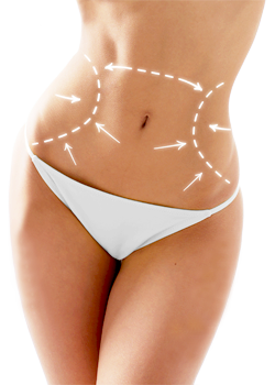 abdominoplastie tunisie