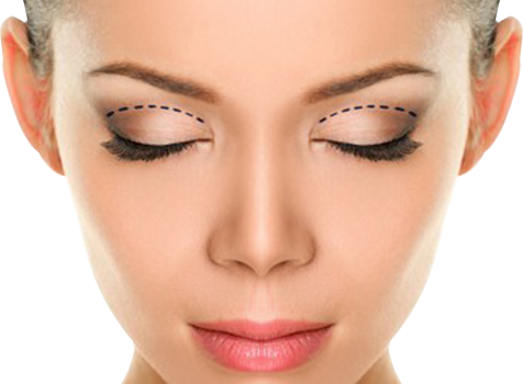 blepharoplastie-en-tunisie