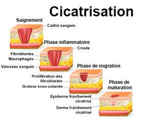 phases-cicatrisation