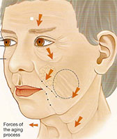 chirurgie-plastique-visage-tunisie