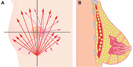 techniques-lipofilling-seins-tunisie