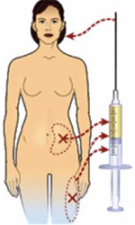 lipofilling-visage-tunisie