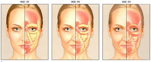 injection-de-graisse-au-visage-tunisie