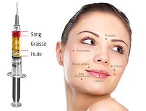 zones-lipofilling-visage-tunisie