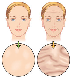 injections-botox-tunisie