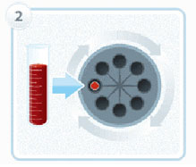 seance-prp-centrifugation